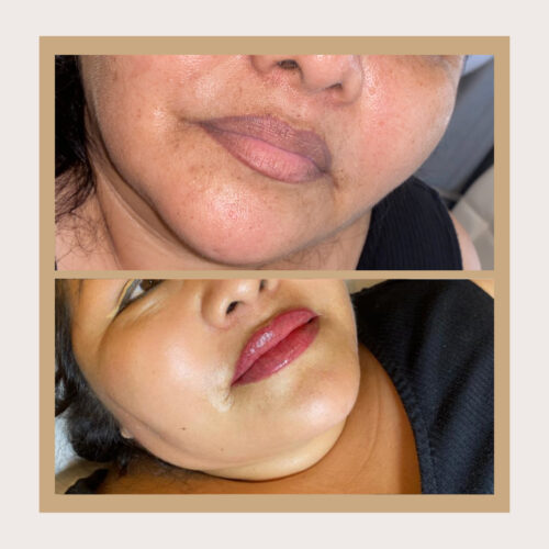 Lip Blushing photo review